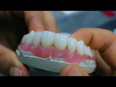 ცირკონო - კერამიკული კბილების დამზადების პროცესი | Dr. Lali Kochiashvili | DENS